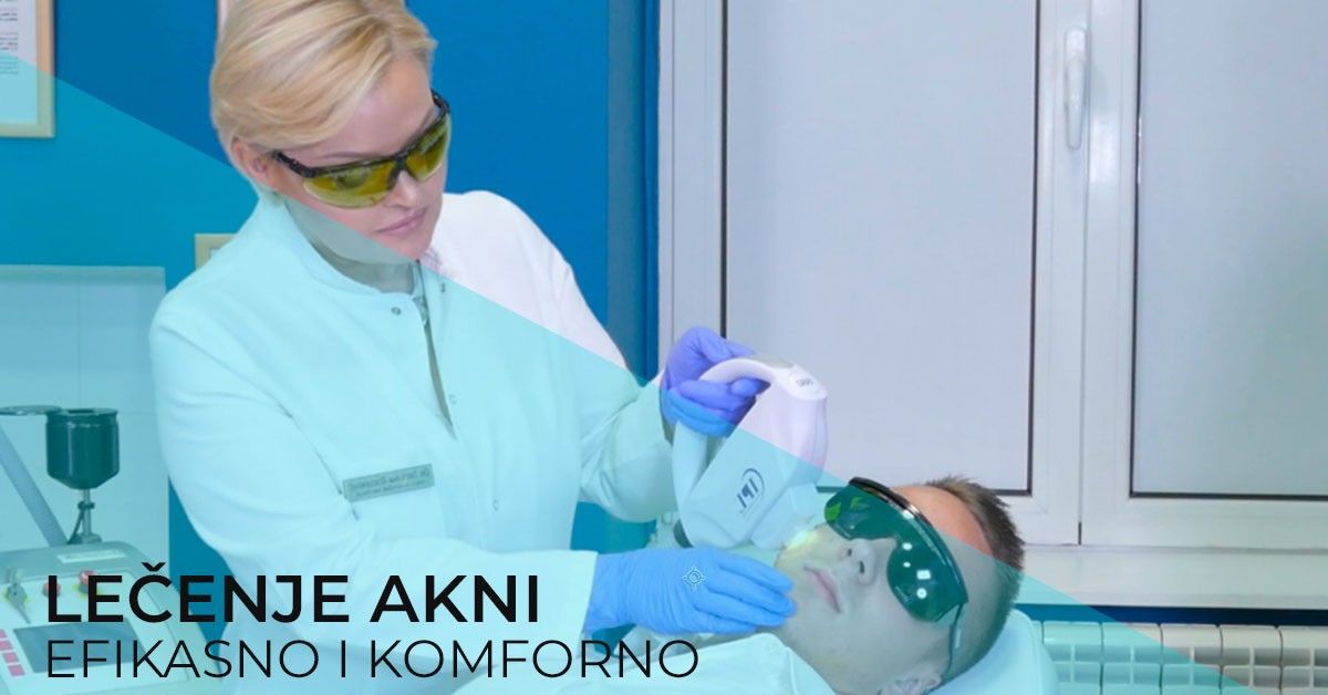 uklanjanje-akni-laserom-lecenje-tretman-lica-diva-poliklinika-dr-bogdanovic-dermatoloska-ordinacija