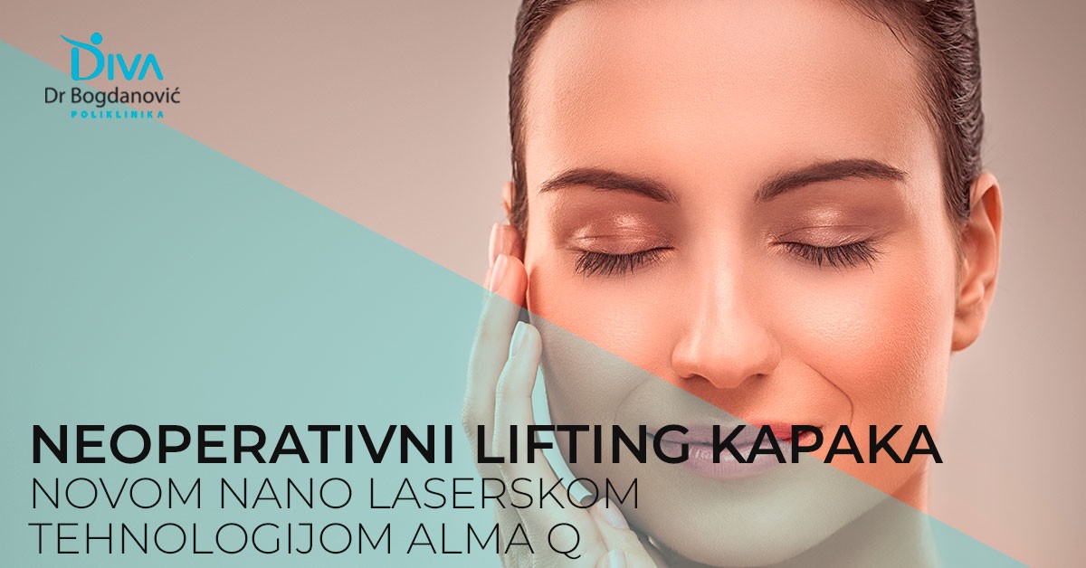 neoperativno-zatezanje-kapaka-lifting-u-poliklinici-diva