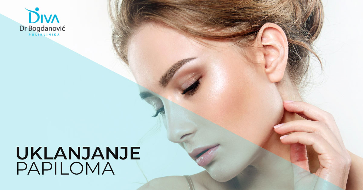 papilomi-efikasan-nacin-za-uklanjanje-papiloma-poliklinika-diva