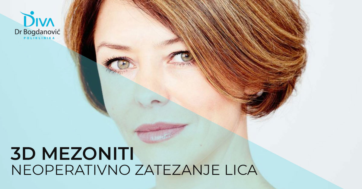 3d-mezoniti-neoperativno-zatezanje-lica-poliklinika-diva-dr-bogdanovic-beograd-lifting