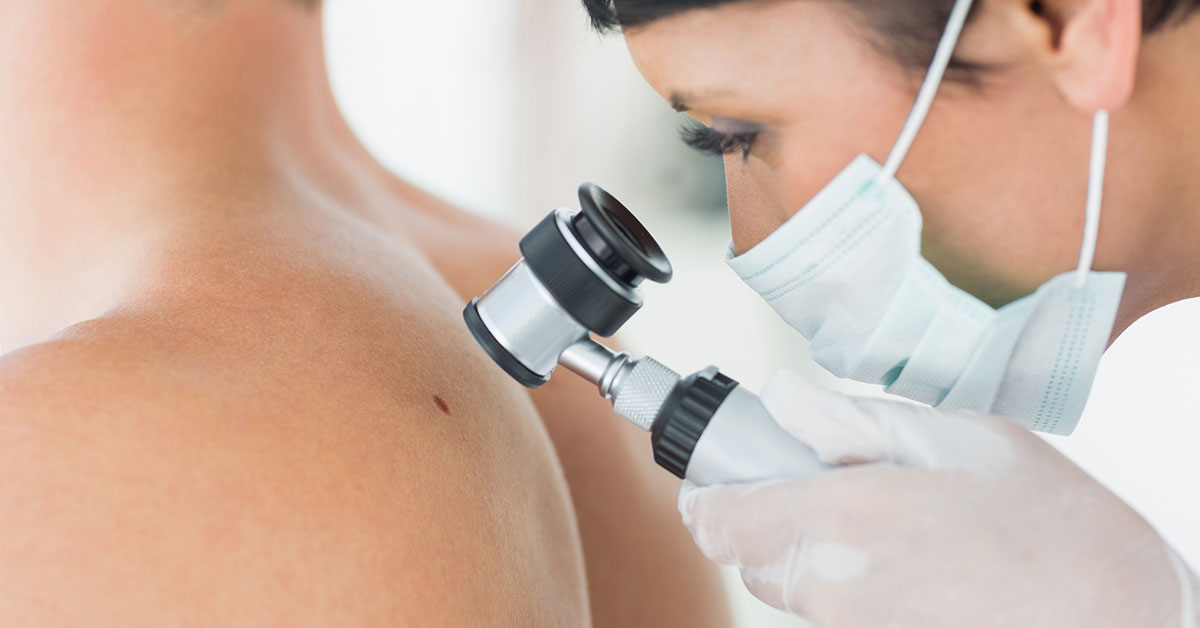 mladezi-bradavice-hijaluron-mezoterapija-diva-uklanjanje-mladez-dermoskopija