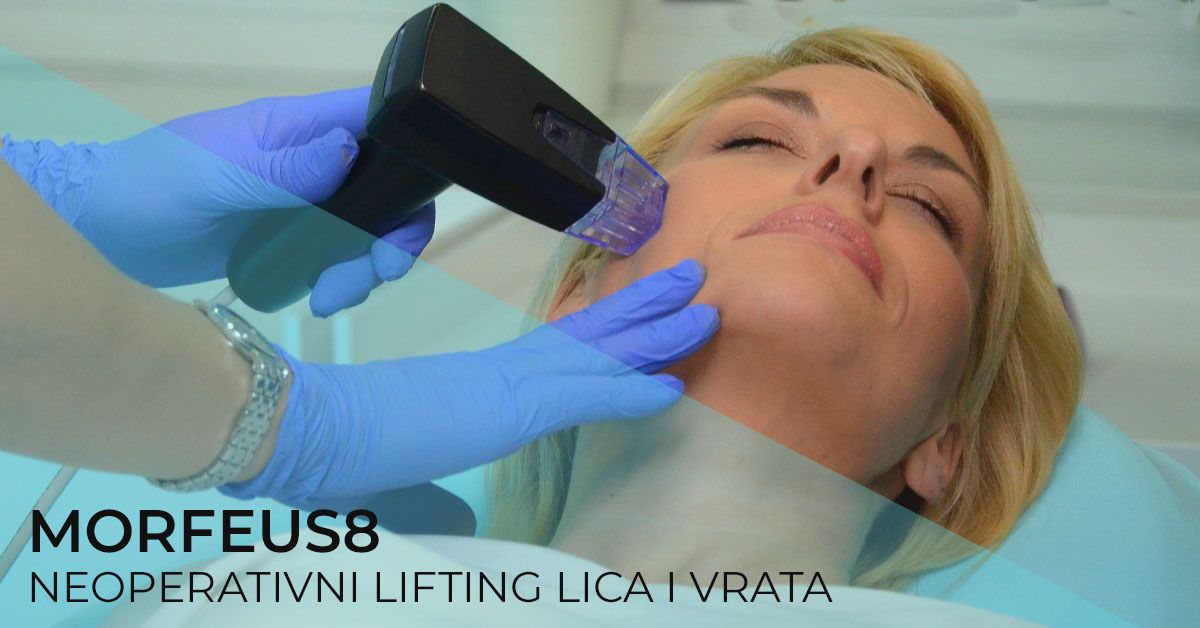 nehirurski-lifting-lica-neoperativni-morfeus-8-poliklinika-diva-dr-bogdanovic-beograd-zatezanje-koze