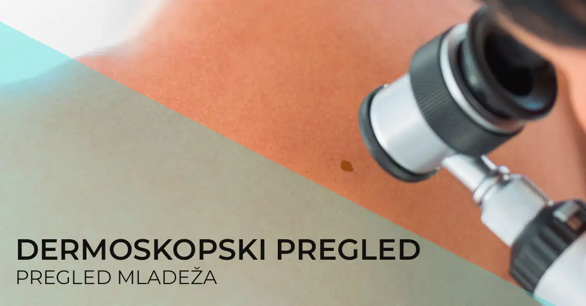 pregled-mladeza-dermoskopija-uklanjanje-mladeza-poliklinika-diva-dr-bogdanovic-radiotalasna-hirurgija