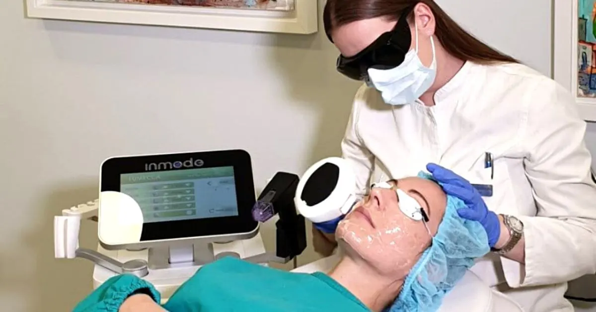 rosacea-lecenje-laserom-poliklinika-diva-dr-bogdanovic-beograd