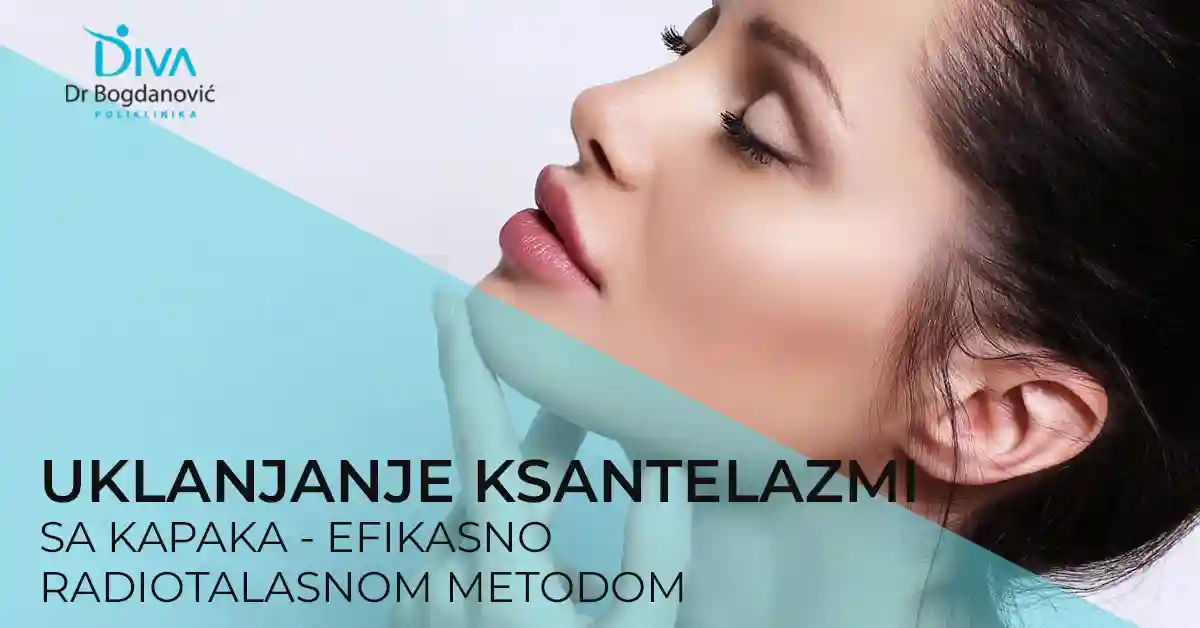 uklanjanje-ksantelazme-lojne-ciste-radio-talasima-poliklinika-diva-dr-bogdanovic