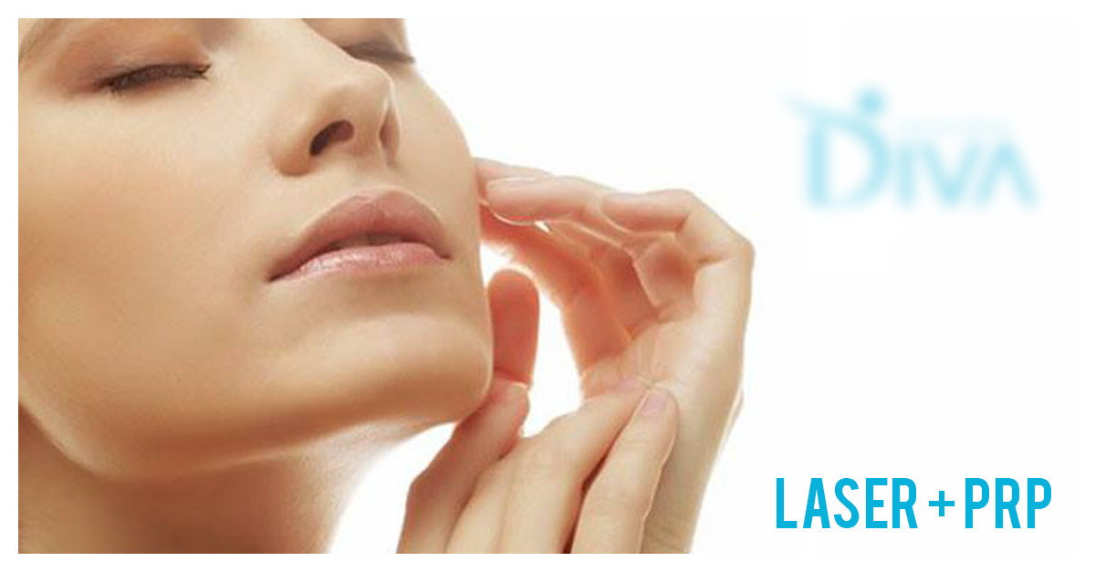 laser-i-prp-podmladjivanje-lep-ten-uklanjanje-oziljaka