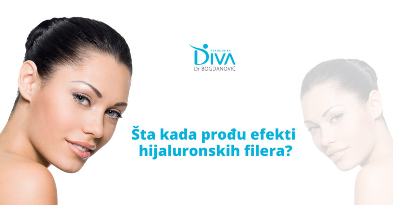 kako-se-koza-ponasa-kada-se-prestane-sa-hijaluronskim-filerima-poliklinika-diva