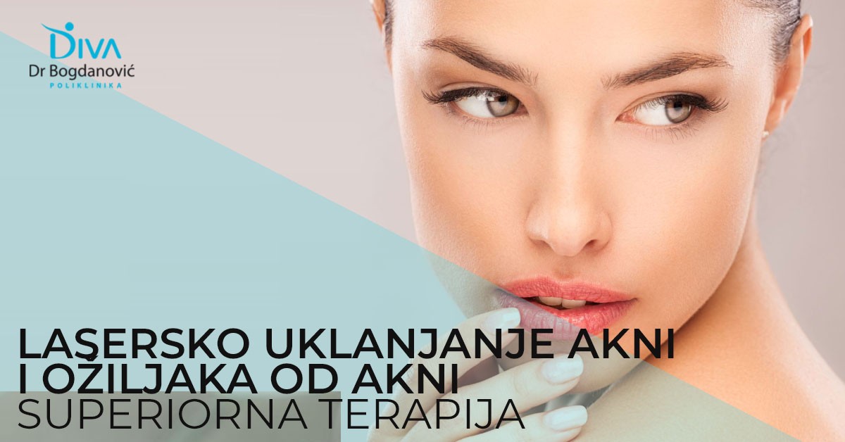 oziljci-od-akni-uklanjanje-laserom-poliklinika-diva-dr-bogdanovic