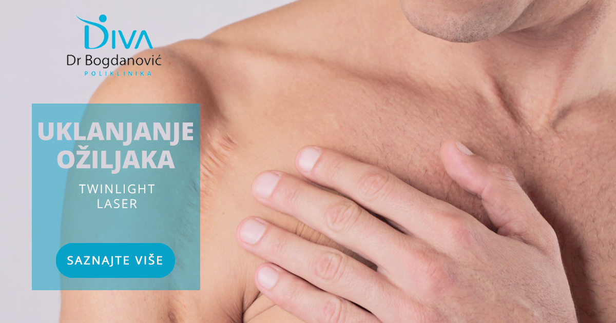 oziljci-vrste-oziljaka-i-njihovo-efikasno-uklanjanje-poliklinika-diva