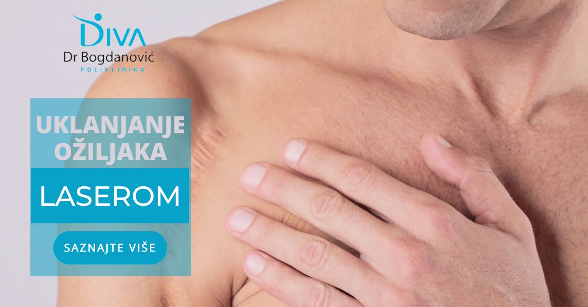 uklanjanje-oziljaka-laserom-poliklinika-diva-dr-bogdanovic-beograd