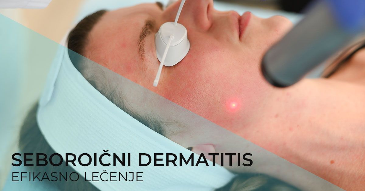 seboroicni-dermatitis-lecenje-laserom-simptomi-uzroci-poliklinika-diva-dr-bogdanovic-beograd-resenje