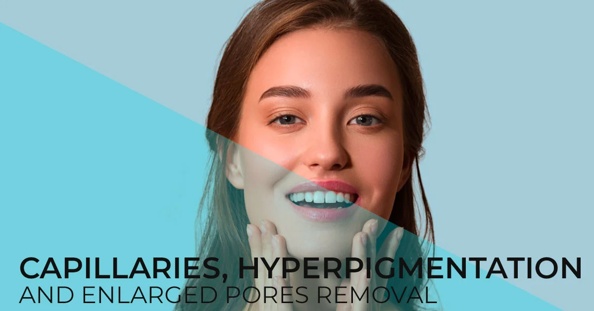 removal-of-capillaries-hyperpigmentation-and-enlarged-pores-diva-clinic
