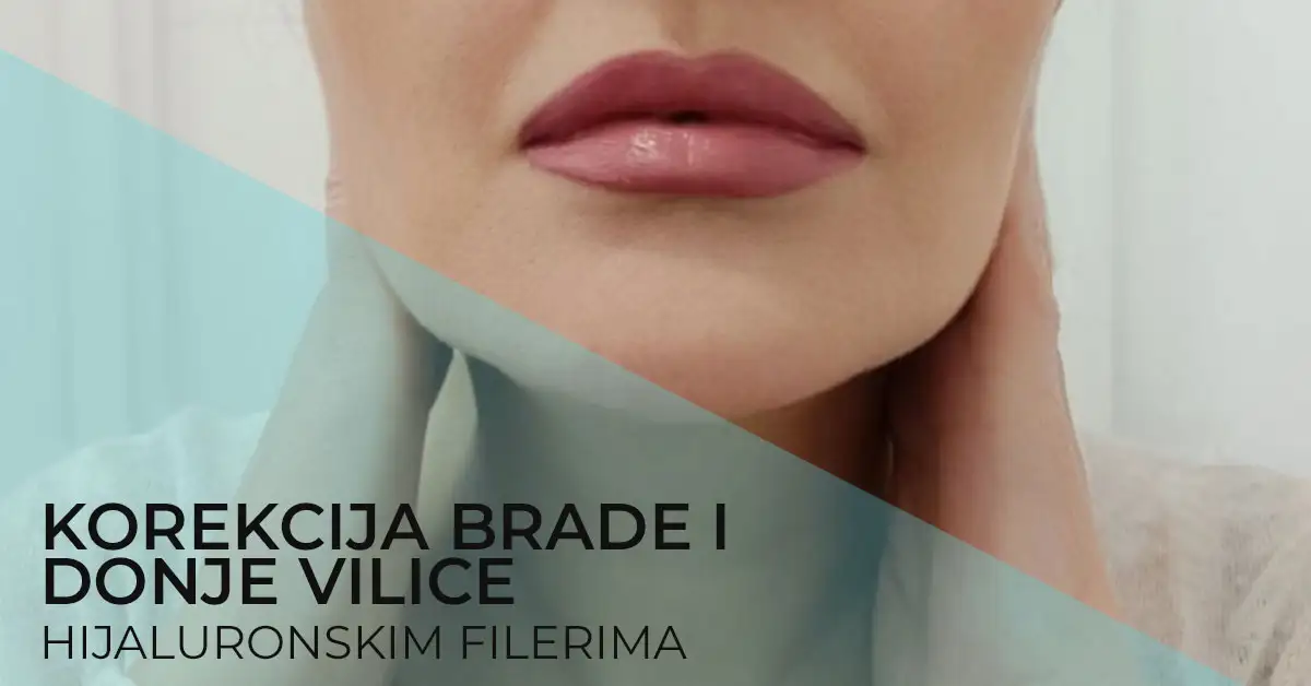 korekcija-brade-hijaluronom-i-oblikovanje-donje-vilice-hijaluronskim-filerima-poliklinika-diva-dr-bogdanovic-beograd