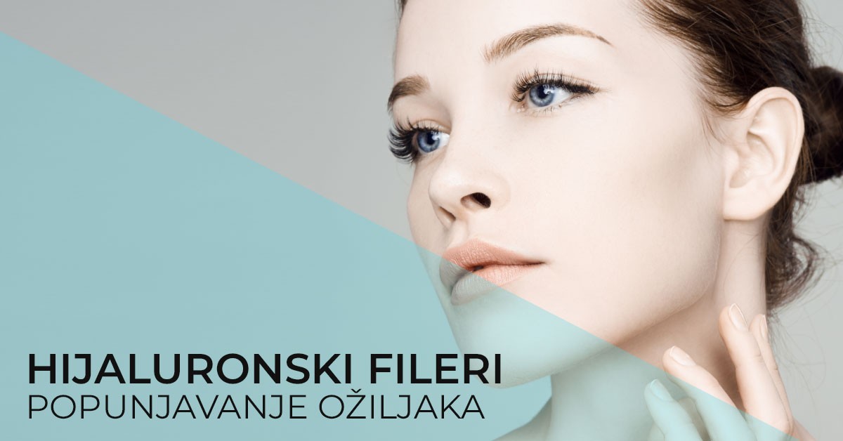popunjavanje-oziljaka-hijaluronom-poliklinika-diva-dr-bogdanovic-beograd