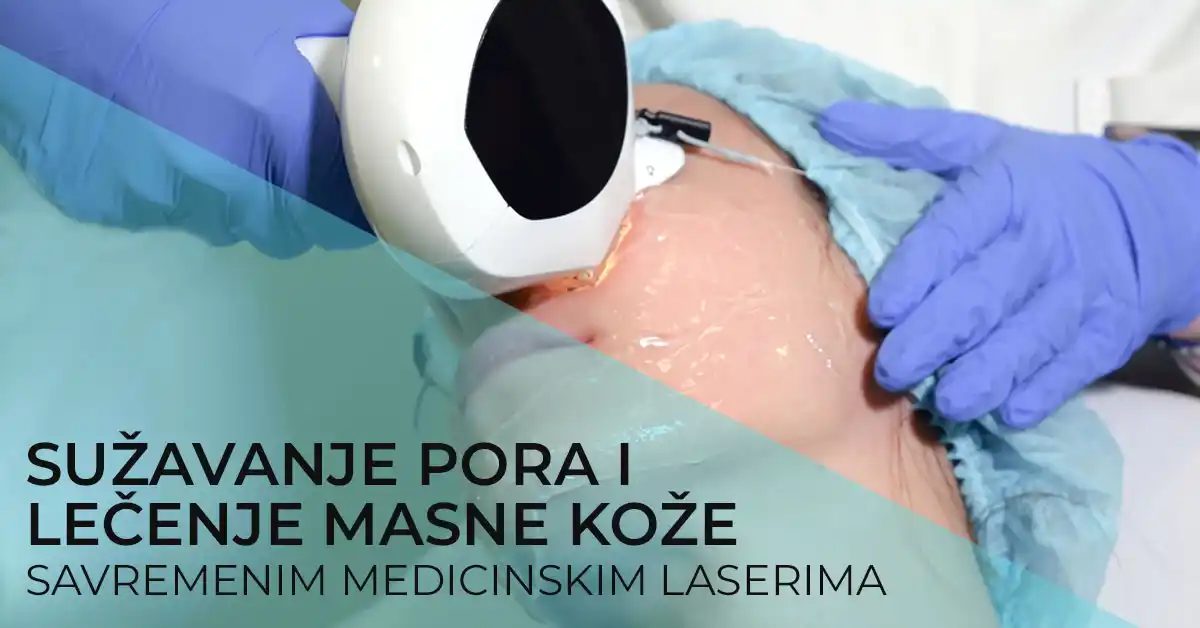 prosirene-pore-suzavanje-uklanjanje-i-problematicna-masna-koza-lecenje-laserom-poliklinika-diva