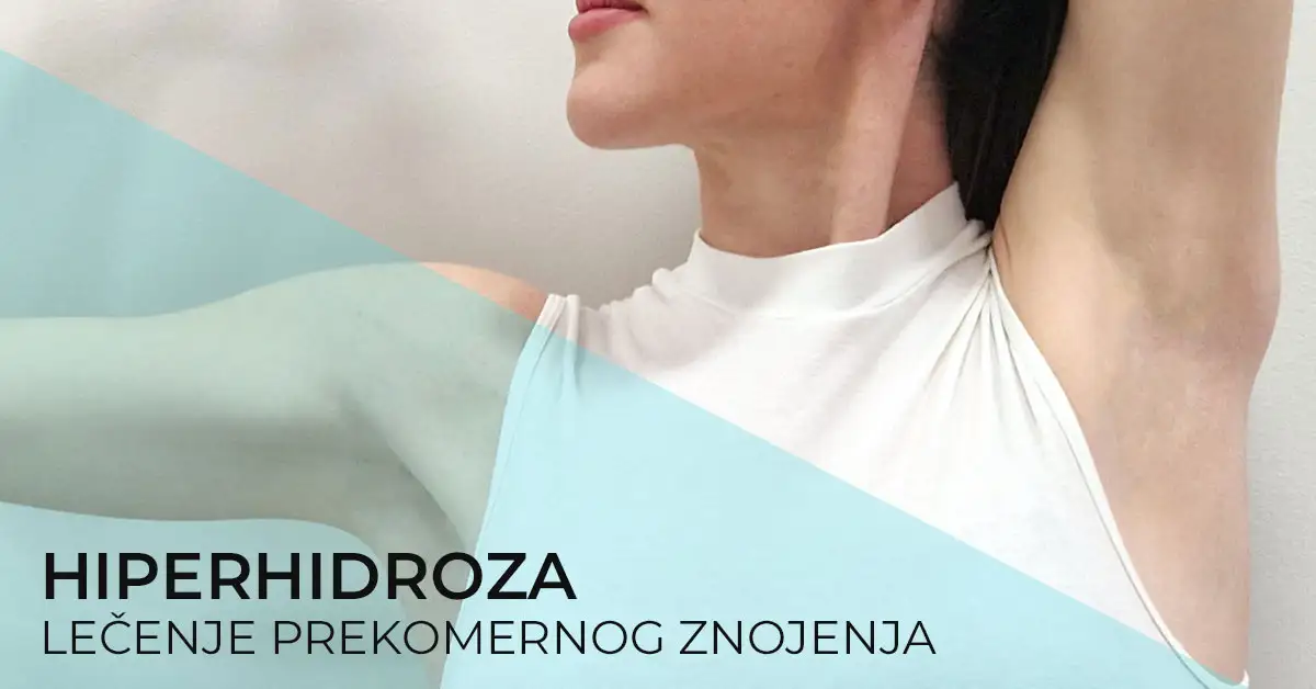 hiperhidroza-prekomerno-znojenje-pojacano-lecenje-poliklinika-diva-dr-bogdanovic