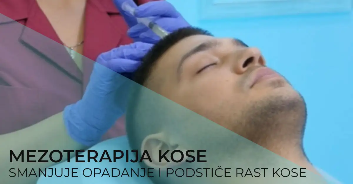 mezoterapija-kose-smanjuje-opadanje-i-podstice-rast-poliklinika-diva