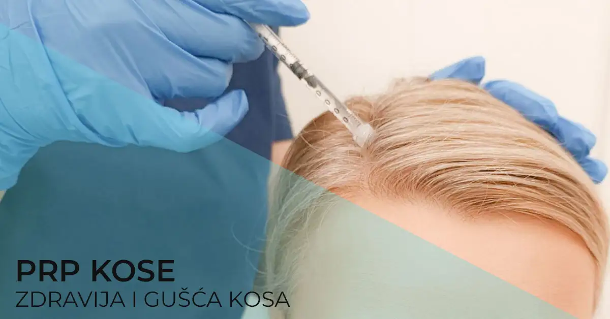 prp-kose-za-lepu-i-zdravu-kosu-poliklinika-diva