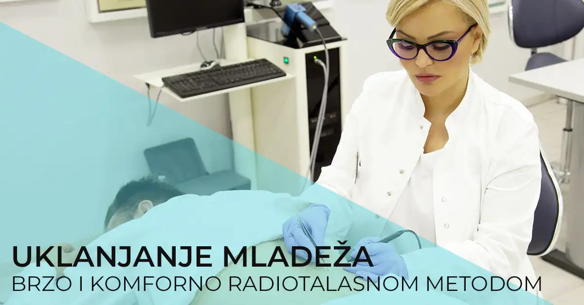 uklanjanje-mladeza-radio-talasima-poliklinika-diva-dr-bogdanovic-beograd-hirurgija-besplatan-pregled