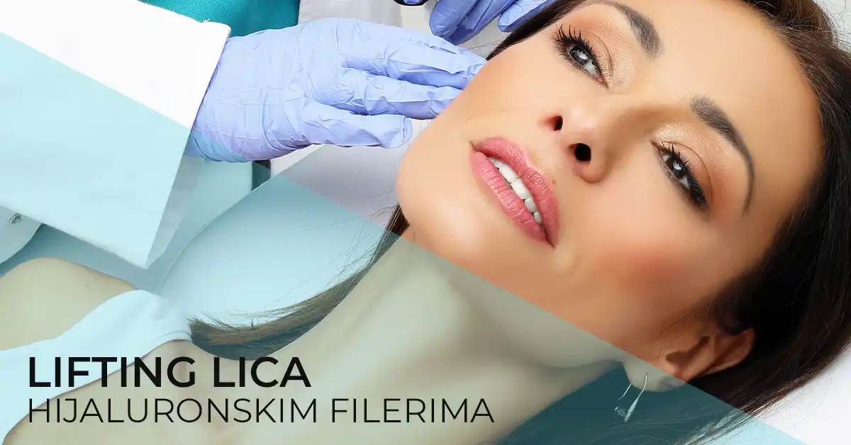 lifting-lica-hijaluronom-poliklinika-diva-dr-bogdanovic
