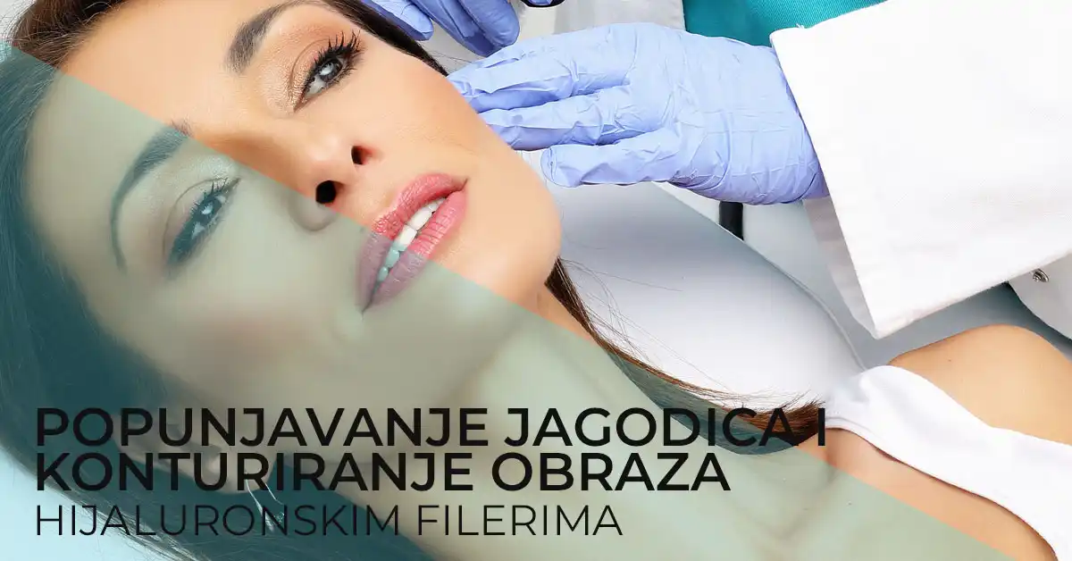 popunjavanje-jagodica-hijaluronom-poliklinika-diva-dr-bogdanovic