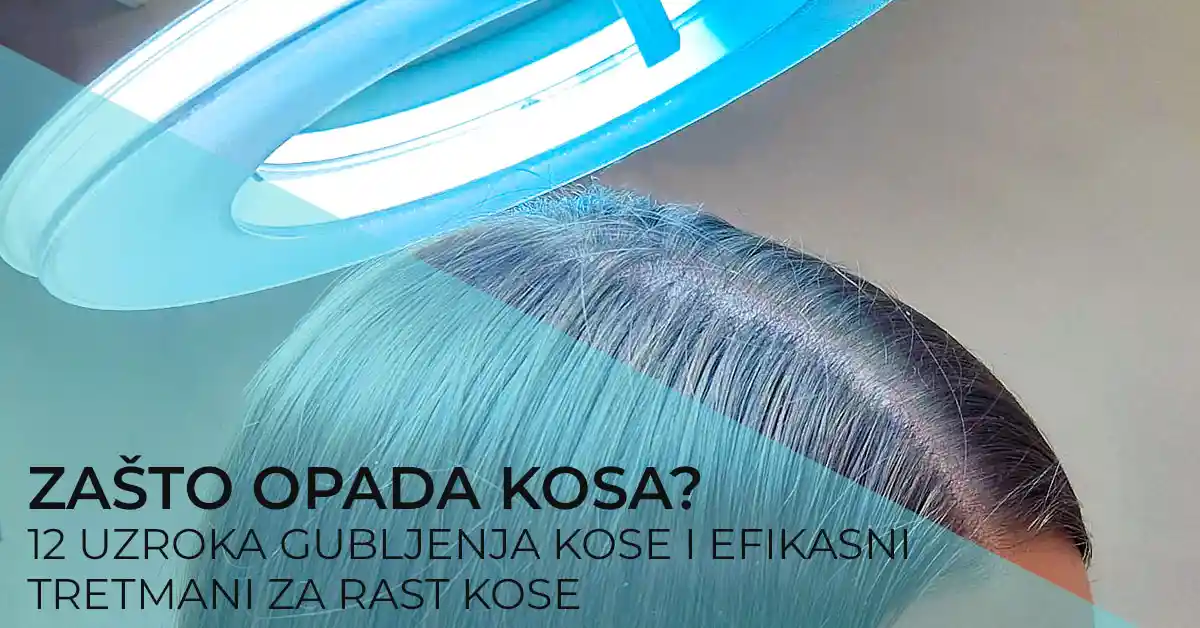 zasto-opada-kosa-poliklinika-diva