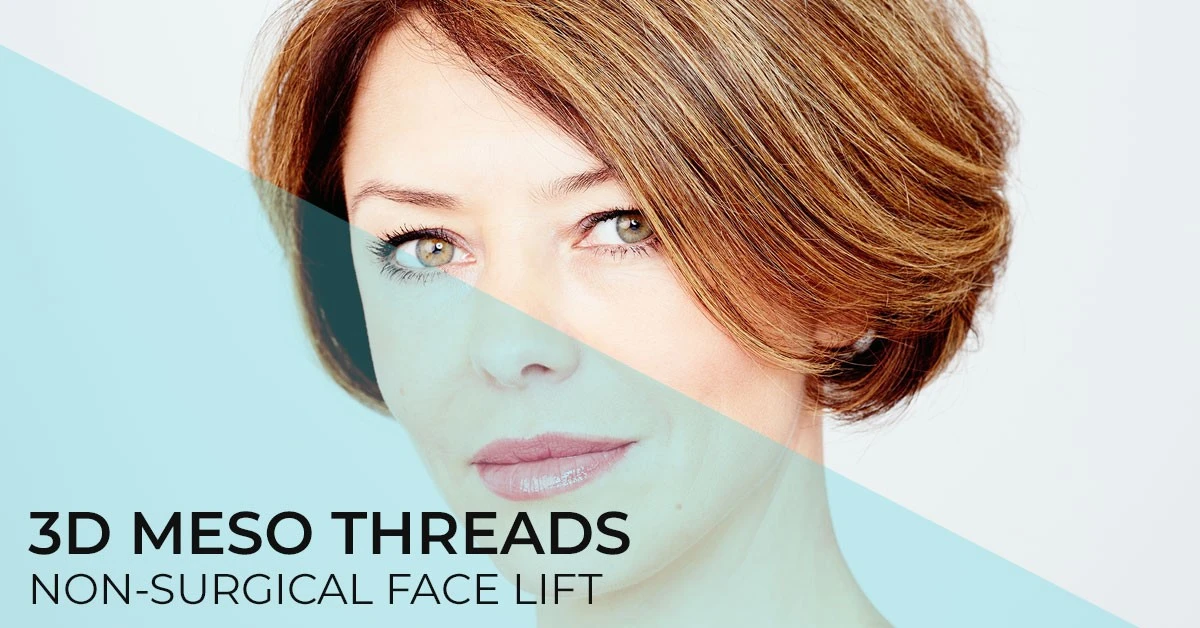 3d-meso-threads-non-surgical-face-lift-clinic-diva-dr-bogdanovic-belgrade-lifting